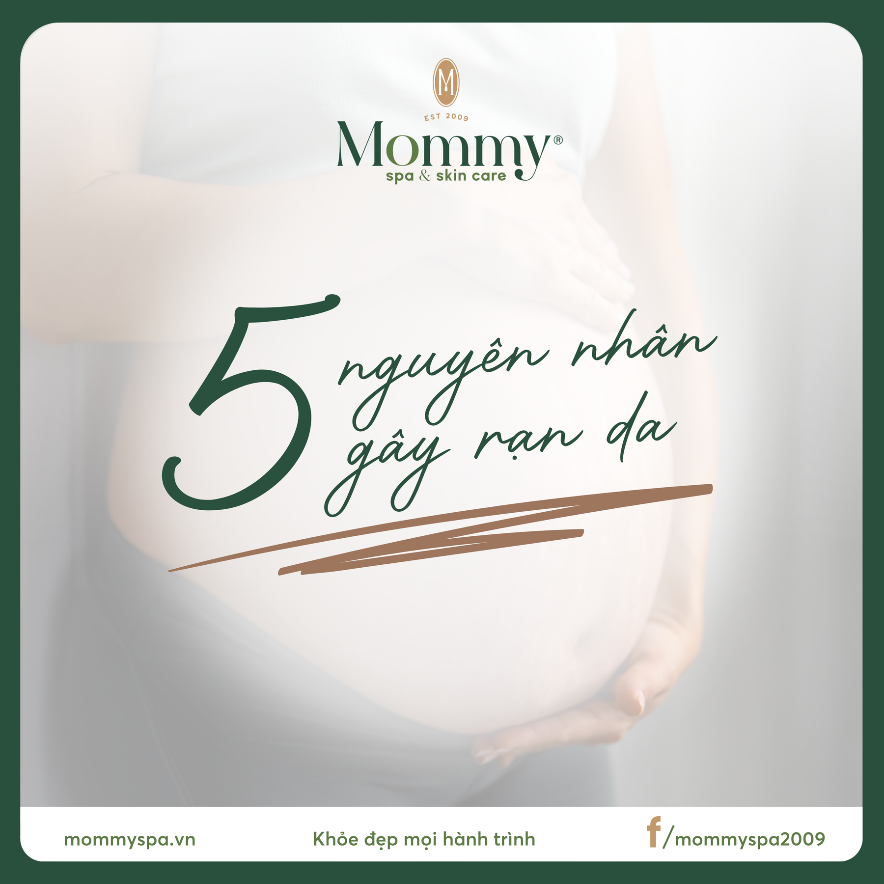 Nguyên nhân gây rạn da sau sinh và cách ngừa